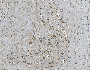 IHC staining of FFPE mouse brain tissue with GABRG2 antibody. HIER: boil tissue sections in pH8 EDTA for 20 min and allow to cool before testing.
