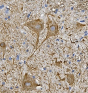 IHC staining of FFPE mouse spinal cord with Neurofilament Light antibody. HIER: boil tissue sections in pH8 EDTA for 20 min and allow to cool before testing.
