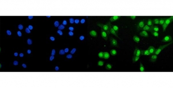 Immunofluorescent staining of FFPE human A549 cells with Huntingtin-associated protein 1 antibody (green) and DAPI nuclear stain (blue). HIER: steam section in pH6 citrate buffer for 20 min.