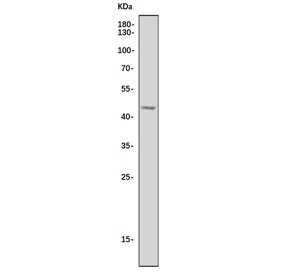 Western blot testing of human Jurkat cell lysate with CCR5 antibody. Predicted molecular weight ~41 kDa.