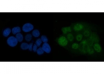 Immunofluorescent staining of FFPE human A431 cells with ATR antibody (green) and DAPI nuclear stain (blue). HIER: steam section in pH6 citrate buffer for 20 min.