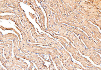 IHC staining of FFPE mouse heart tissue with PLB antibody, HRP-secondary and DAB substrate. HIER: boil tissue sections in pH8 EDTA for 20 min and allow to cool before testing.