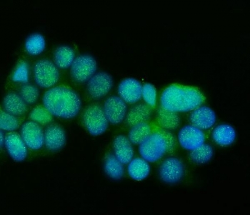 Immunofluorescent staining of FFPE human RT4 cells with PSEN1 antibody (green) and DAPI nuclear stain (blue). HIER: steam section in pH6 citrate buffer for 20 min.