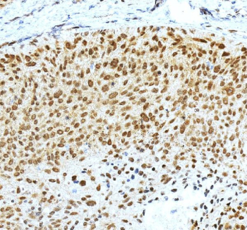 IHC staining of FFPE rat stomach tissue with Krueppel-like factor 4 antibody. HIER: boil tissue sections in pH8 EDTA for 20 min and allow to cool before testing.
