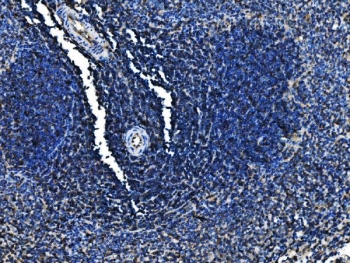 IHC staining of FFPE rat spleen tissue with Cd6 antibody. HIER: boil tissue sections in pH8 EDTA for 20 min and allow to cool before testing.