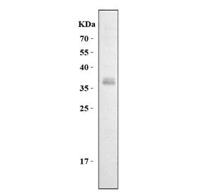 Western blot testing of rat thymus lysate with Cd7 antibody. Expected molecular weight: 25-40 kDa depending on glycosylation level.