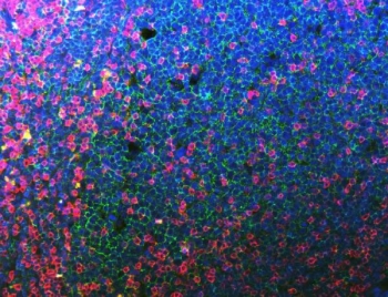 Immunofluorescent staining of FFPE human tonsil tissue with CD20 antibody (green), CD3e antibody (red) and DAPI nuclear stain (blue). HIER: steam section in pH8 EDTA buffer for 20 min.