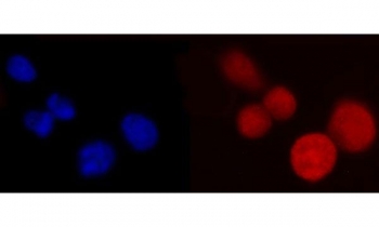 Immunofluorescent staining of FFPE human Caco-2 cells with Poly(rC)-binding protein 2 antibody (red) and DAPI nuclear stain (blue). HIER: steam section in pH6 citrate buffer for 20 min.