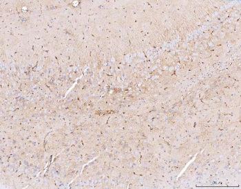 IHC staining of FFPE mouse brain tissue with Aquaporin 4 antibody. HIER: boil tissue sections in pH8 EDTA for 20 min and allow to cool before testing.