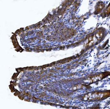 IHC staining of FFPE rat colon tissue with Itgae antibody. HIER: boil tissue sections in pH8 EDTA for 20 min and allow to cool before testing.