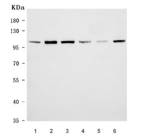 Western blot testing of 1) human U-87 MG, 2) human SH-SY5Y, 3) human HeLa, 4) human MCF7, 5) rat brain and 6) rat C6 cell lysate with EAG1 antibody. Predicted molecular weight ~111 kDa (may be observed larger than predicted due to glycosylation).