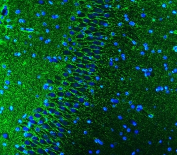 Immunofluorescent staining of FFPE rat brain tissue with EAAT1 antibody (green) and DAPI nuclear stain (blue). HIER: steam section in pH8 EDTA buffer for 20 min.