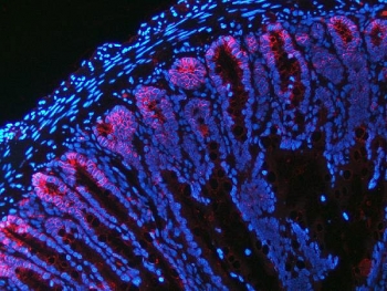 Immunofluorescent staining of FFPE rat colon tissue with NKCC1 antibody (red) and DAPI nuclear stain (blue). HIER: steam section in pH8 EDTA buffer for 20 min.