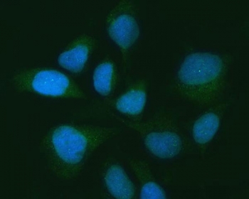 Immunofluorescent staining of FFPE human HeLa cells with Ubiquitin carboxyl-terminal hydrolase 16 antibody (green) and DAPI nuclear stain (blue). HIER: steam section in pH6 citrate buffer for 20 min.