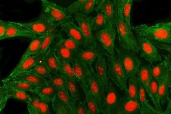 Immunofluorescent staining of FFPE human U-2 OS cells with SAE1 antibody (red) and Alpha Tubulin mAb (blue). HIER: steam section in pH6 citrate buffer for 20 min.