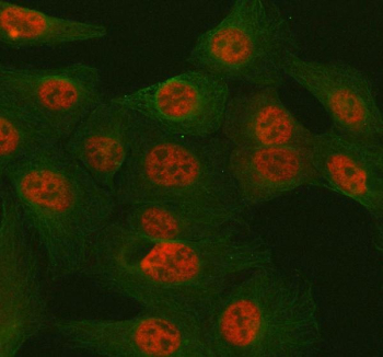 Immunofluorescent staining of FFPE human U-2 OS cells with TULP3 antibody (red) and Alpha Tubulin mAb (green). HIER: steam section in pH6 citrate buffer for 20 min.