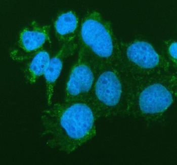 Immunofluorescent staining of FFPE human Caco-2 cells with SIAE antibody (green) and DAPI nuclear stain (blue). HIER: steam section in pH6 citrate buffer for 20 min.