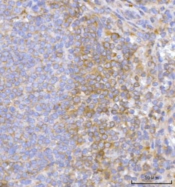 IHC staining of FFPE human spleen tissue with Hamartin antibody. HIER: boil tissue sections in pH8 EDTA for 20 min and allow to cool before testing.
