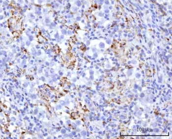 IHC staining of FFPE human testicular seminoma tissue with UBXN8 antibody. HIER: boil tissue sections in pH8 EDTA for 20 min and allow to cool before testing.