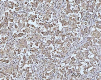 IHC staining of FFPE human testicular seminoma tissue with BCAP antibody. HIER: boil tissue sections in pH8 EDTA for 20 min and allow to cool before testing.