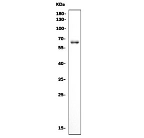 Western blot testing of rat brain tissue with Crmp4 antibody. Predicted molecular weight ~62 kDa.
