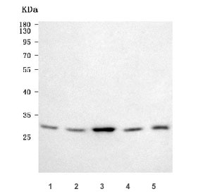 Western blot testing of 1) human 293T, 2) human Jurkat, 3) human HeLa, 4) rat L6 and 5) mouse NIH 3T3 cell lysate with GCLM antibody. Predicted molecular weight ~31 kDa.
