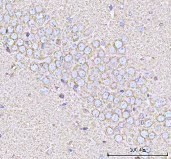 IHC staining of FFPE rat brain tissue with Calcineurin B antibody. HIER: boil tissue sections in pH8 EDTA for 20 min and allow to cool before testing.