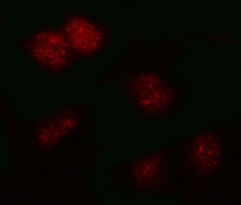 Immunofluorescent staining of FFPE human HeLa cells with PSMB2 antibody (red). HIER: steam section in pH6 citrate buffer for 20 min.