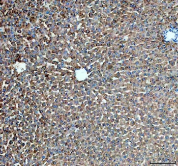 IHC staining of FFPE rat liver tissue with PYGL antibody. HIER: boil tissue sections in pH8 EDTA for 20 min and allow to cool before testing.