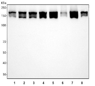 Western blot testing of 1) human HeLa, 2) human 293T, 3) human K562, 4) human PC-3, 5) rat brain, 6) rat kidney, 7) mouse brain and 8) mouse kidney tissue lysate with Clathrin heavy chain antibody. Predicted molecular weight ~192 kDa.