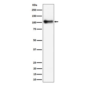Western blot testing of mouse lung tissue lysate with Thbd antibody. Expected molecular weight ~60/100 kDa (unmodified/glycosylated).