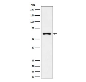Western blot testing of human 293T cell lysate with EYA2 antibody. Predicted molecular weight ~59 kDa.