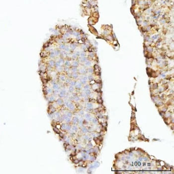 IHC staining of FFPE mouse testis tissue with GHRH antibody. HIER: boil tissue sections in pH8 EDTA for 20 min and allow to cool before testing.