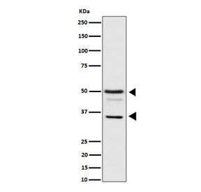 Western blot testing of human HeLa cell lysate with BAG family molecular chaperone regulator 1 antibody. Predicted molecular weight ~50 kDa (long form), 29-33 (short form).