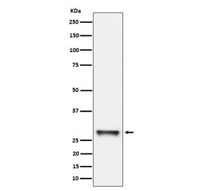 Western blot testing of human K562 cell lysate with PNMT antibody. Predicted molecular weight ~31 kDa.