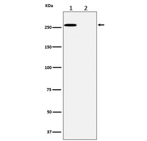 Western blot testing of lysate from A431 cells 1) untreated and 2) treated with lambda phosphatase, with Phospho-ACACA antibody.