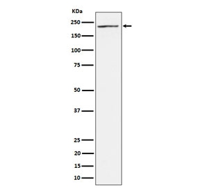 Western blot testing of human 293T cell lysate with MEKK4 antibody. Predicted molecular weight: 177-182 kDa (two isoforms).