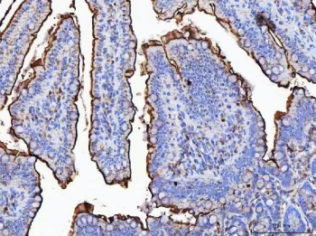 IHC staining of FFPE rat colon tissue with Maltase-glucoamylase antibody. HIER: boil tissue sections in pH8 EDTA for 20 min and allow to cool before testing.