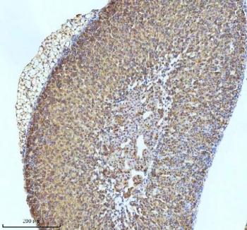 IHC staining of FFPE mouse adrenal tissue with GCLM antibody. HIER: boil tissue sections in pH8 EDTA for 20 min and allow to cool before testing.