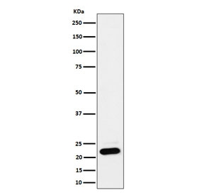 Western blot testing of human HEK293 cell lysate with NDUFB9 antibody. Predicted molecular weight ~22 kDa.