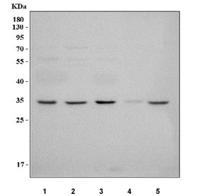Western blot testing of 1) human 293T, 2) human ThP-1, 3) human K532, 4) rat testis and 5) mouse testis tissue lysate with NUP42 antibody. Predicted molecular weight ~36 kDa.