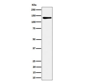 Western blot testing of human HeLa cell lysate with MCM2 antibody. Commonly observed at 100-130 kDa.