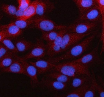 Immunofluorescent staining of FFPE human HeLa cells with MARCH2 antibody (red) and DAPI nuclear stain (blue). HIER: steam section in pH6 citrate buffer for 20 min.