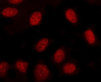 Immunofluorescent staining of FFPE human U-2 OS cells with MINDY3 antibody (red). HIER: steam section in pH6 citrate buffer for 20 min.
