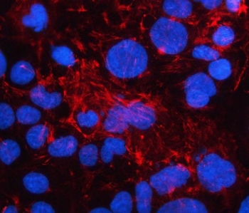 Immunofluorescent staining of FFPE human Caco-2 cells with Ladinin 1 antibody (red) and DAPI nuclear stain (blue). HIER: steam section in pH6 citrate buffer for 20 min.