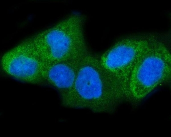 Immunofluorescent staining of FFPE human HeLa cells with Insulin-induced gene 1 antibody (green) and DAPI nuclear stain (blue). HIER: steam section in pH6 citrate buffer for 20 min.