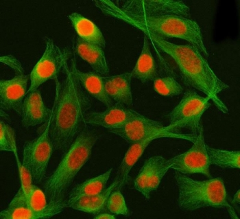 Immunofluorescent staining of FFPE human HeLa cells with PSIP1 antibody (red) and Beta Tubulin mAb (green). HIER: steam section in pH6 citrate buffer for 20 min.