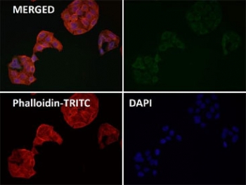 Immunofluorescent staining of FFPE human HeLa cells with FDX1 antibody (green), Phalloidin (red) and DAPI nuclear stain (blue). HIER: steam section in pH6 citrate buffer for 20 min.