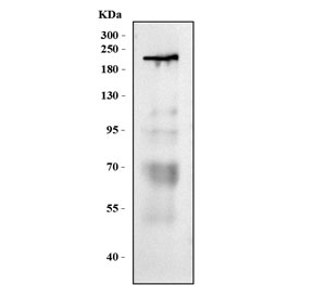 Western blot testing of human placental tissue lysate with VEGFR-1 antibody. Predicted molecular weight ~150 kDa but may be observed at higher molecular weights due to glycosylation.