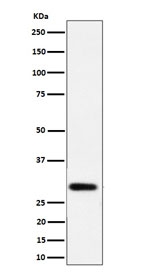 Western blot testing of human LnCaP cell lysate with N-acetyltransferase 1 antibody. Predicted molecular weight ~34 kDa.